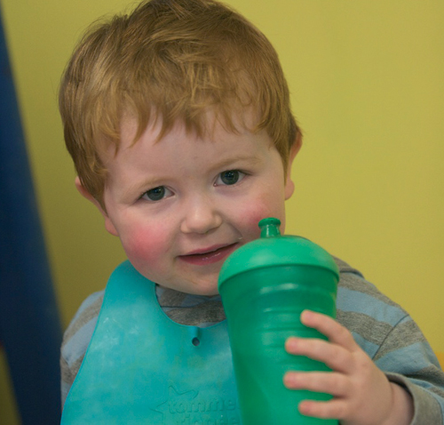 Nutrition: Food Allergies